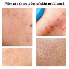 EMS Microcurrent Facial Lifting Device