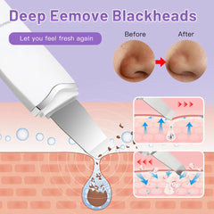 Ultrasonic Skin Scrubber