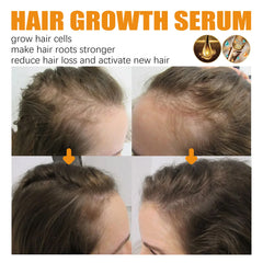 Biotin Hair Care Spray – Hair Loss & Scalp Nourishing