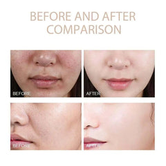 Rice Exfoliating Essence