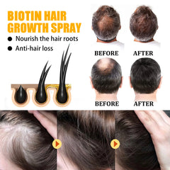 Biotin Hair Care Spray – Hair Loss & Scalp Nourishing