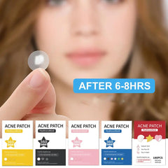 360pcs Invisible Acne Pimple Patch Stickers
