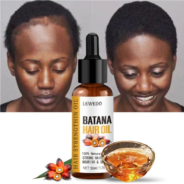 Naturals Batana Oil – Fast Hair Growth