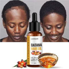 Naturals Batana Oil – Fast Hair Growth