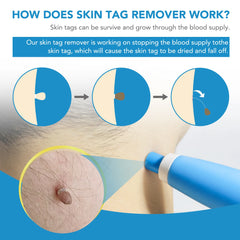 2-in-1 Skin Tag & Mole Remover Device