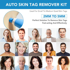 2-in-1 Skin Tag & Mole Remover Device